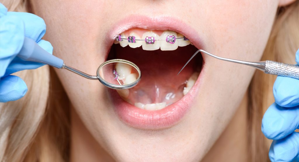 best dentist in satellite best dentist in satellite