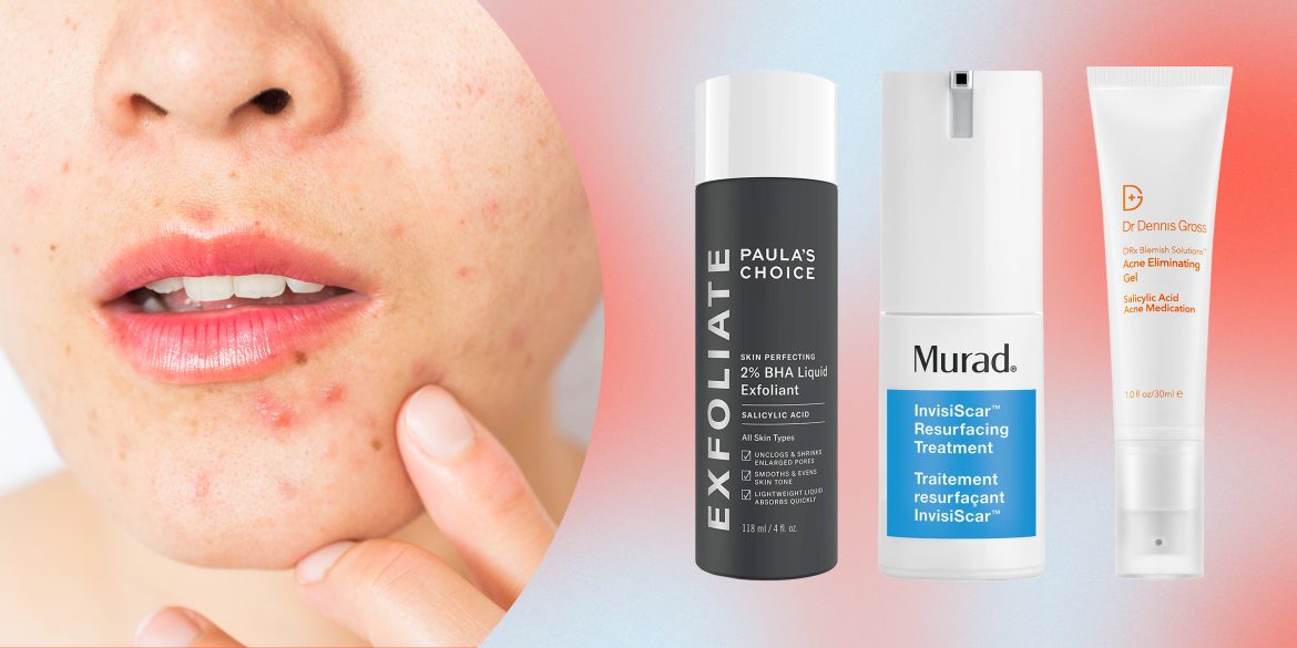 5 Methods for getting Freed of Pimples Fast Skincare