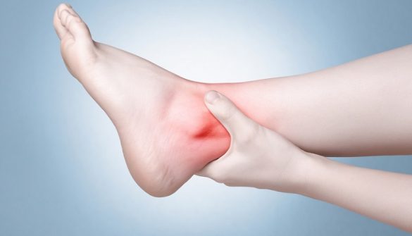 What is Achilles Tendinitis?