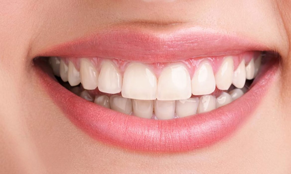 professional teeth whitening near me