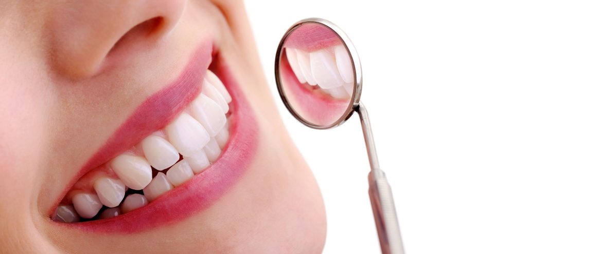 dental veneers near me