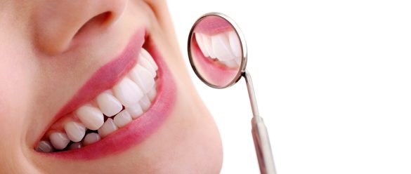 dental veneers near me