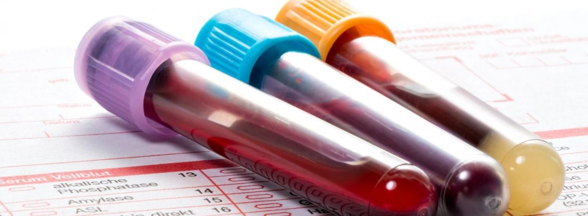 at home phlebotomy services