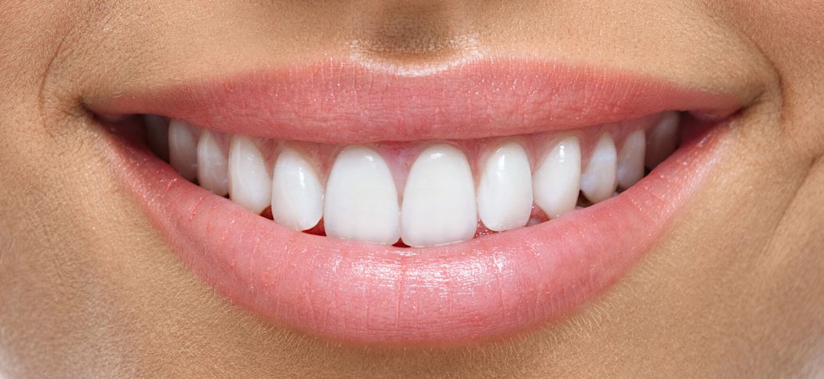 temporary dental implant