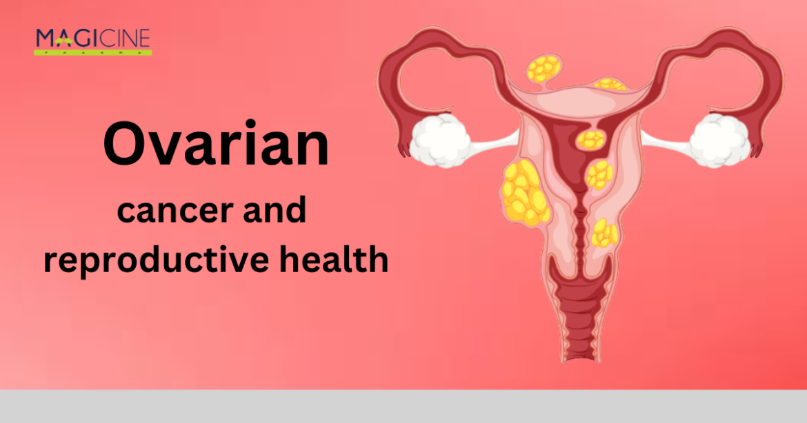ovarian cancer
