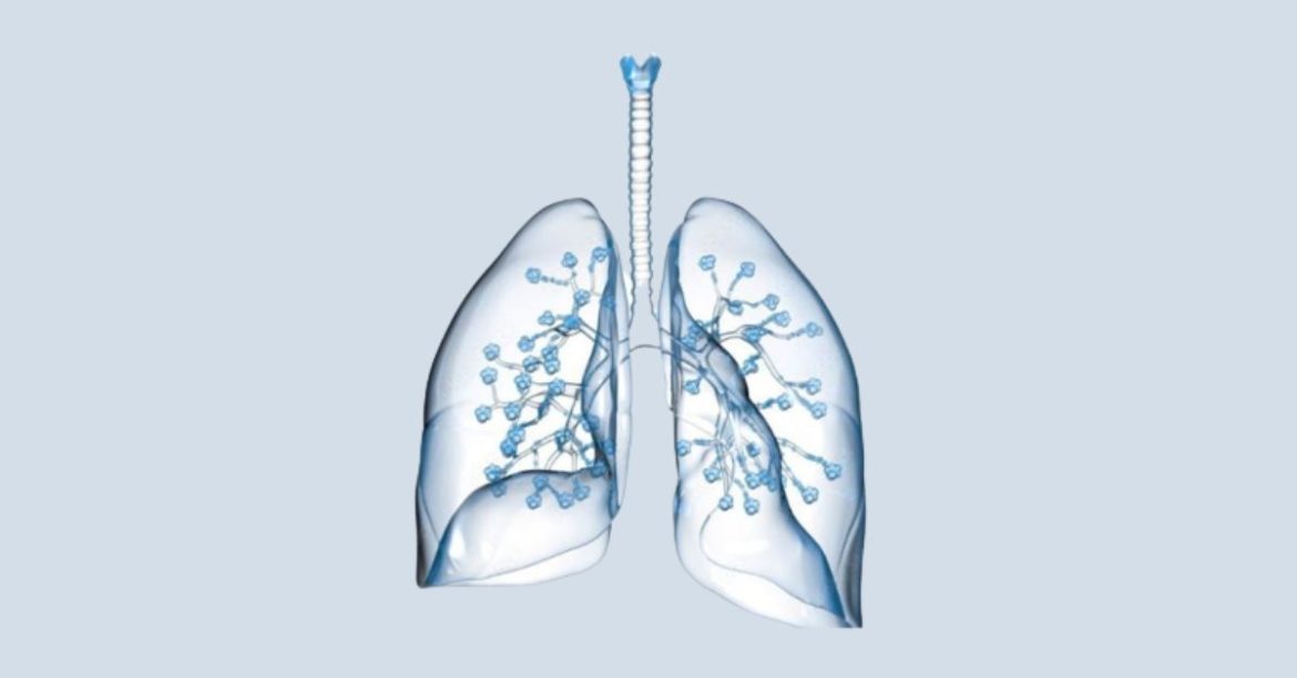 Medicine for lung cancer